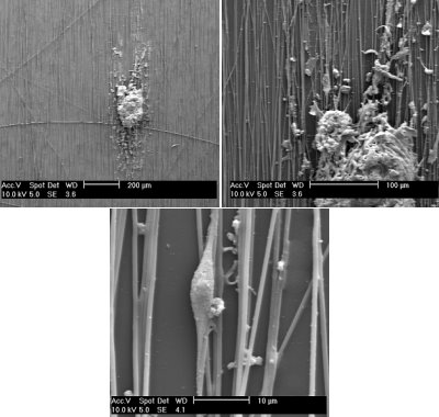 Scanning electron microscope images of an ex-vivo human glioblastoma tumor sample cultured on aligned nanofibers showing the tumor dispersion along the nanofibers exactly how they would migrate in vivo along the white matter within the brain and central nervous system.