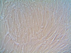 Lung Squamous Cell Carcinoma CAFs in culture. Grown using CAF Growth Media (cat. CAFM03)