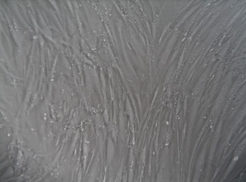 Pancreatic CAFs in culture. Grown using CAF Growth Media (cat. CAFM03)