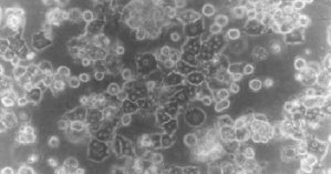 Primary hepatocyte culture in 3D model using our CollaGel Hydrogel.