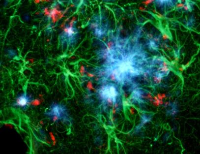 Human brain astrocytes grown in Collagel Hydrogel