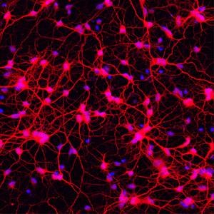 Primary human neurons grown in Collagel Hydrogel