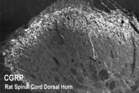 CGRP