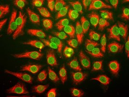 Human HeLa cells stained with Vimentin and our 39C7 nuclear pore complex marker.