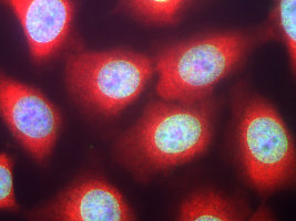 HeLa cells stained with chicken casein kinase 1 alpha antibody (red) and our panspecific mouse monoclonal antibody to nuclear pore complexes 39C7-a Panspecific Nuclear Pore Complex Marker. Casein kinase 1 alpha has a particulate distribution both in the nucleus and the cytoplasm. Blue is the Hoeschst DNA stain