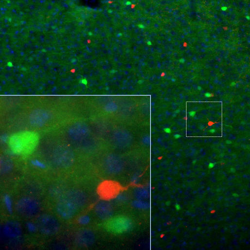 Adult rat cortex section was co-stained with Calretinin (CH22116; red) and our mouse anti-calbindin antibody (MO22146; green). Each antibody specifically labels a subset of interneurons (i.e., calretinin-positive or calbindin-postive) that express each marker exclusively. Insets are high-magnification images of the boxed area in each picture. Blue is Dapi staining that labels DNA.