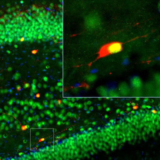 Adult rat brain cortex sections (45 μM; fixed by transcardial perfusion with 4% paraformaldehyde) were stained with our Calbindin (1:1,000, red), and our monoclonal mouse Fox3/NeuN (MO22112 ). Calbindin labels a subset of sparsely-distributed interneurons (calbindin-positvie interneurons) in the cortex. Since neurons also express Fox3/NeuN, calbindin-positive cells appear to be gold to yellow. Insets are high magnification images of boxed area of each image. Blue is Dapi nucleus staining.