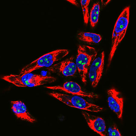 Confocal immunofluorescent analysis of HeLa cells stained with chicken pAb to fibrillarin, CH22129, dilution 1:10,000 in green and costained with mouse mAb to vimentin in red. The blue signal is DAPI staining of nuclear DNA. The fibrillarin antibody stains nucleoli while the vimentin antibody binds to cytoplasmic intermediate filaments.