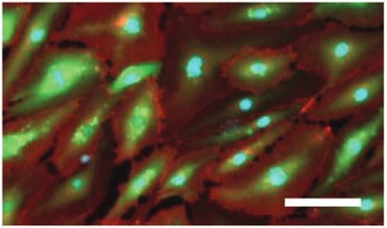 GFP-HUVECs stained with VE-Cadherin and DAPI on an egg white based hydrogel.