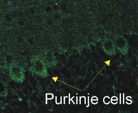 P2x2 staining of Cerebellar Purjinke cell layer. ~50 μm sections from 3 brains from P15 rats. http://stke.sciencemag.org/cgi/data/sigtrans;1/41/ra8/DC1/1