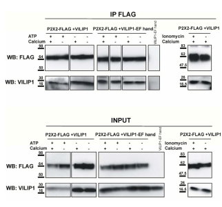 The constitutive interaction between P2X2 receptors and VILIP1 is calcium independent. www.sciencesignaling.org/cgi/content/full/1/41/ra8/DC1