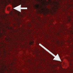 NPY staining of striatal rat interneurones (arrows).