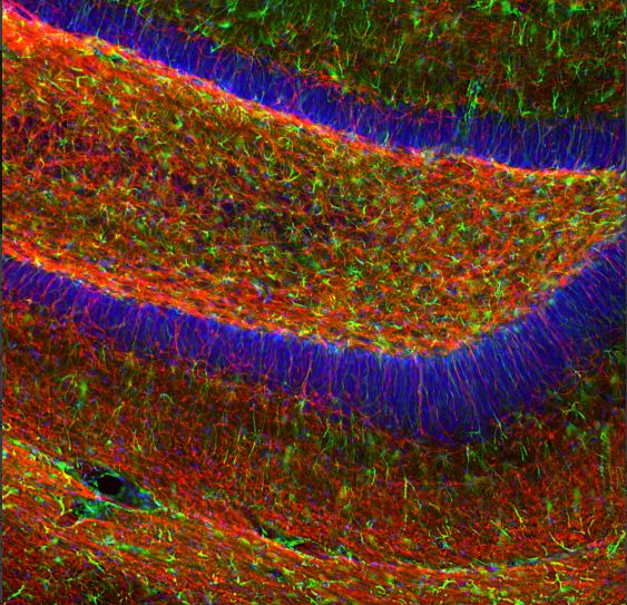: Immunofluorescent analysis of mouse hippocampus section stained with goat pAb to myelin basic protein (MBP), GT22104, dilution 1:5,000 in red, and costained with rabbit pAb to GFAP, dilution 1:5,000 in green.