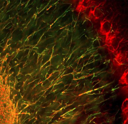 Immunofluorescence analysis of mouse cerebellum section stained with goat pAb to NF-H, GT22109, dilution 1:3,000 in red, and costained with mouse mAb to myelin basic protein (MBP) in green. The NF-H antibody labels axons of basket and Purkinje cells and others. The MBP antibody stains oligodendrocyte cell bodies and the myelin sheathes around axons in the granular layer at center and the white matter at bottom left.