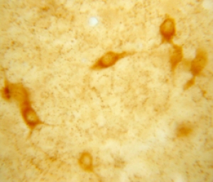 Vesicular Acetylcholine Transporter