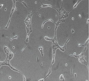 HUVECs cultured using our Collagel Hydrogel