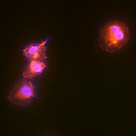HBMECs stained with CD146