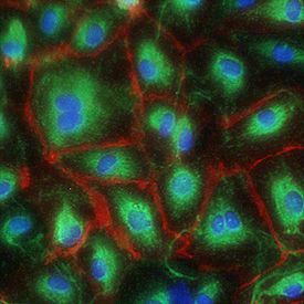 Human Pancreatic Microvascular Endothelial Cells (HEC08) are stained with vWF (red) and CD31 (green). Nuclei counterstained blue with DAPI. As you can see, CD31 is on cell membrane whereas vWF is in the cytoplasm.