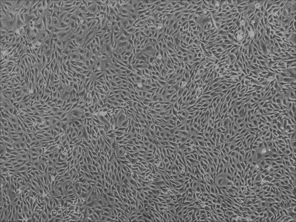 Retinal Microvascular Endothelial Cells in culture