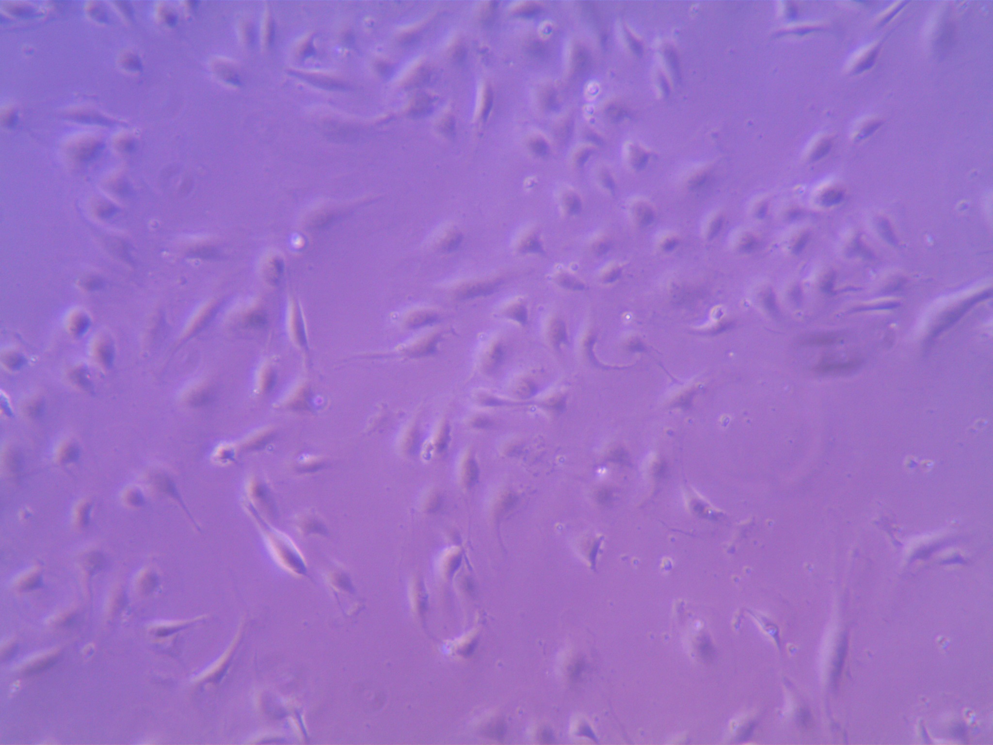 Human Large Intestine Microvascular Endothelial Cells in two days in culture.