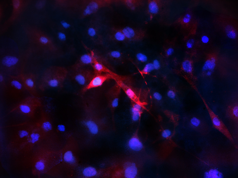 Staining of VWF/Factor VIII (dilution 1:100). Secondary antibody conjugated to Alexa 594 (red) and counterstained with DAPI (blue). Cell were mounted using iBrite mounting media.