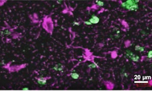Primary Human Astrocytes in Culture-https://doi.org/10.1186/s12974-022-02509-8