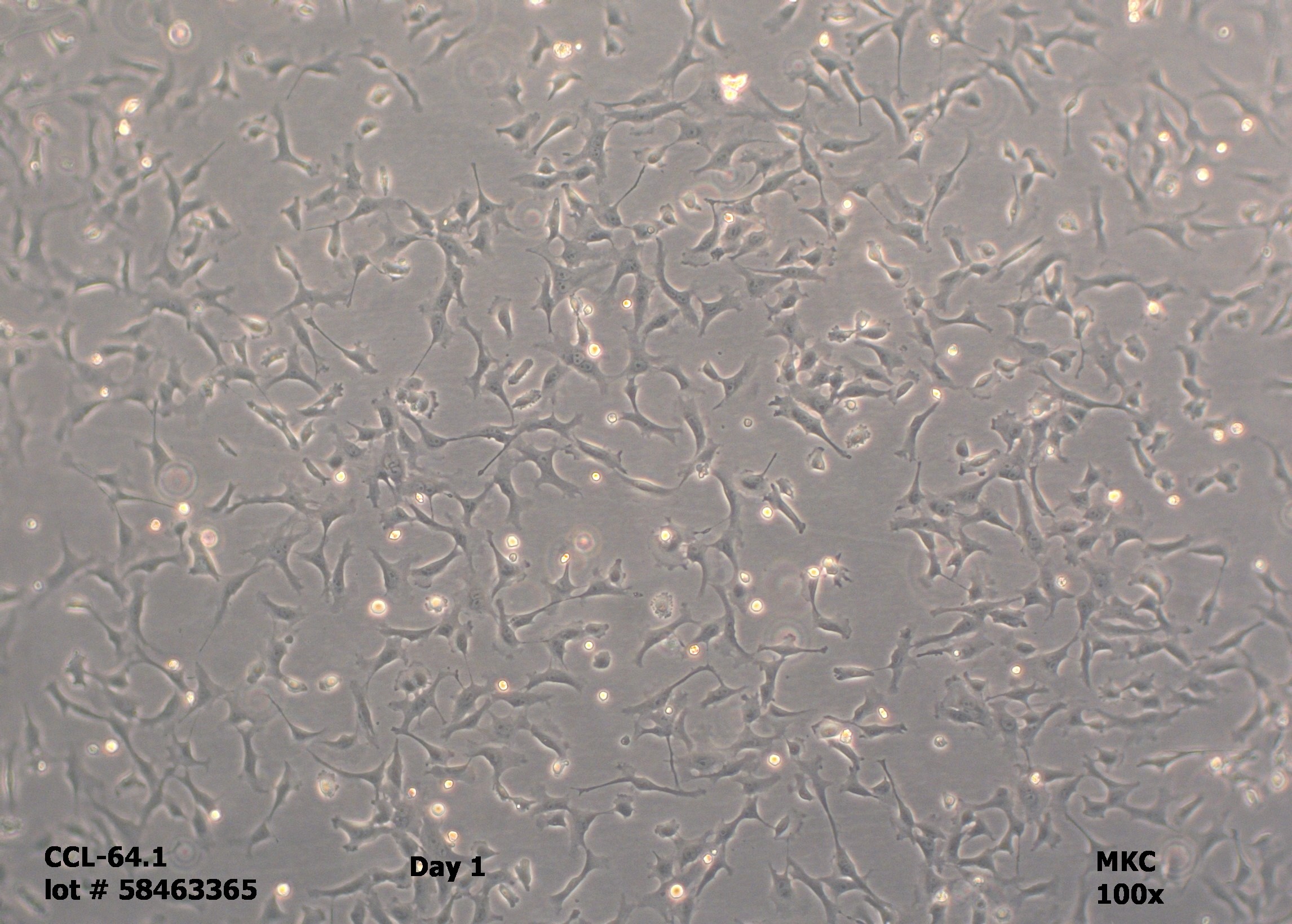 Primary Human Neurons
