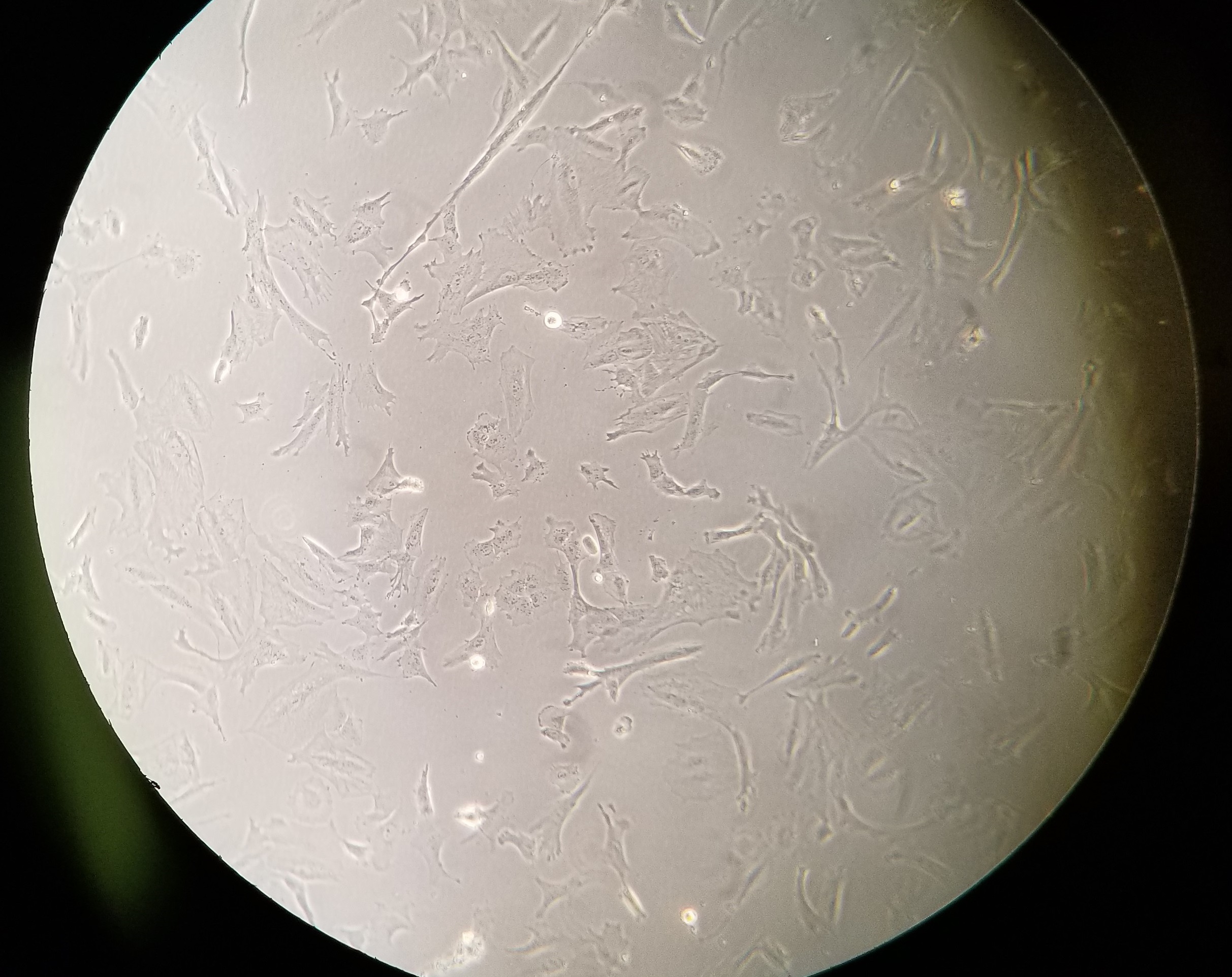 Human neurons cultured alone. Data courtesy of Edu at Scripps.