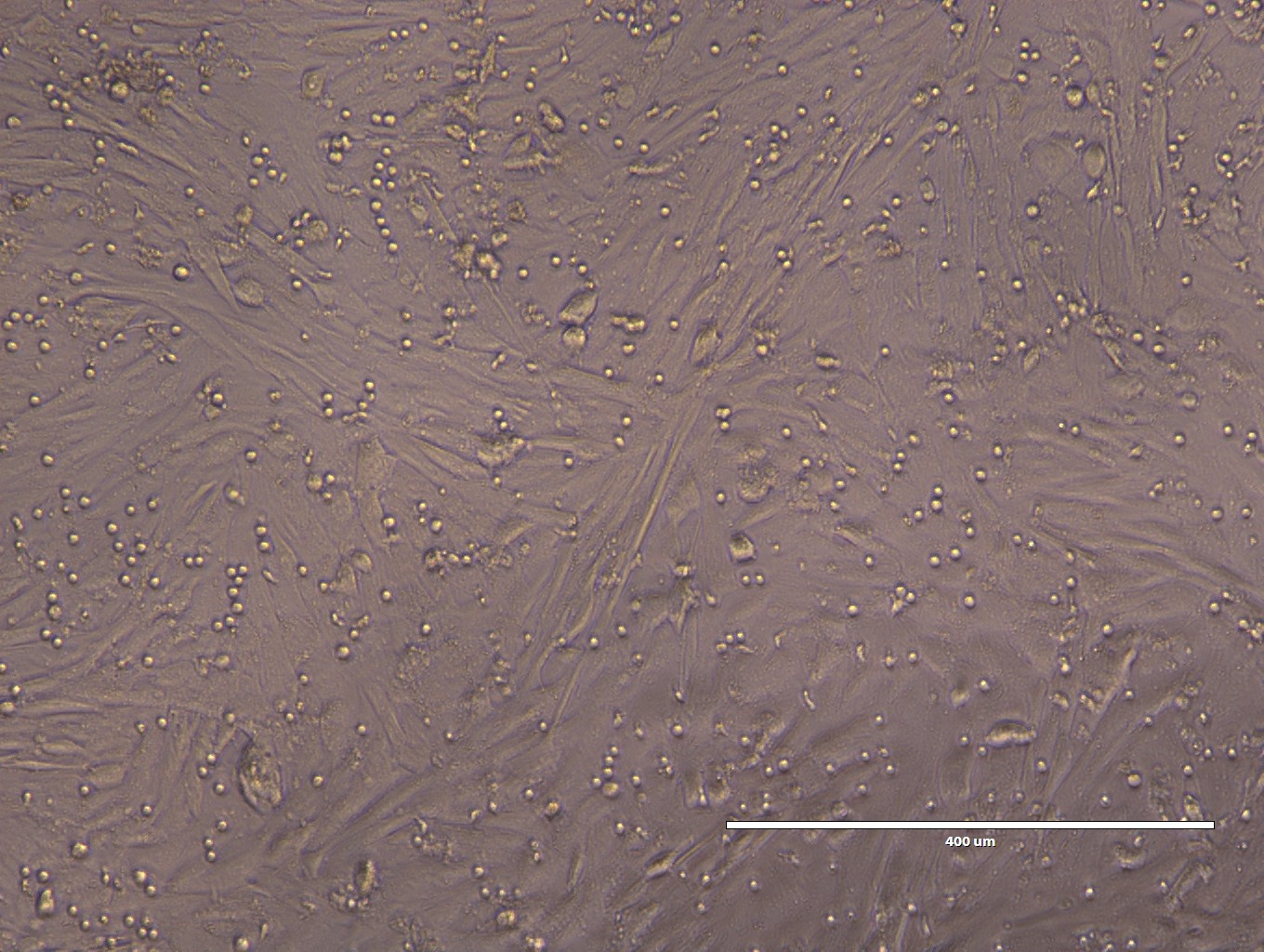 Human neurons cultured with T-cells. Data courtesy of Edu at Scripps.