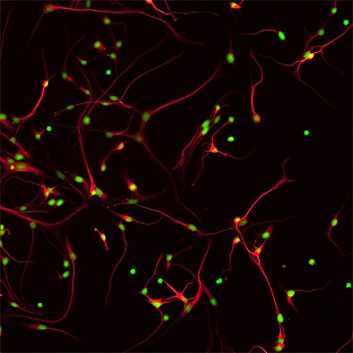 Primary Human Cortical Neurons, HNC001
