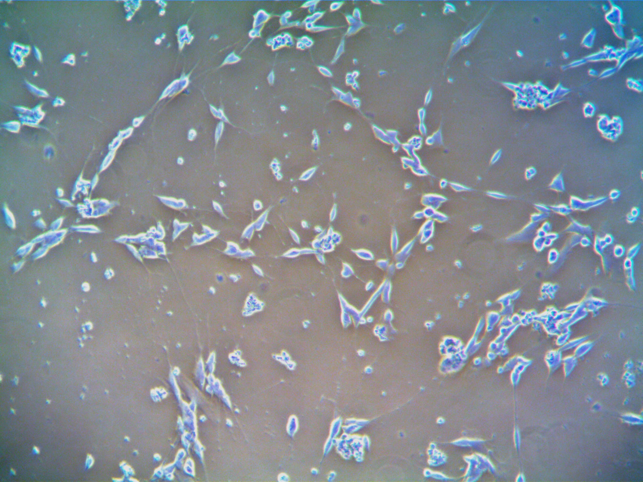 Primary Human Neurons (cat. HNC001) cultured using Universal Neurite Outgrowth Media. Neurite formation can be seen.