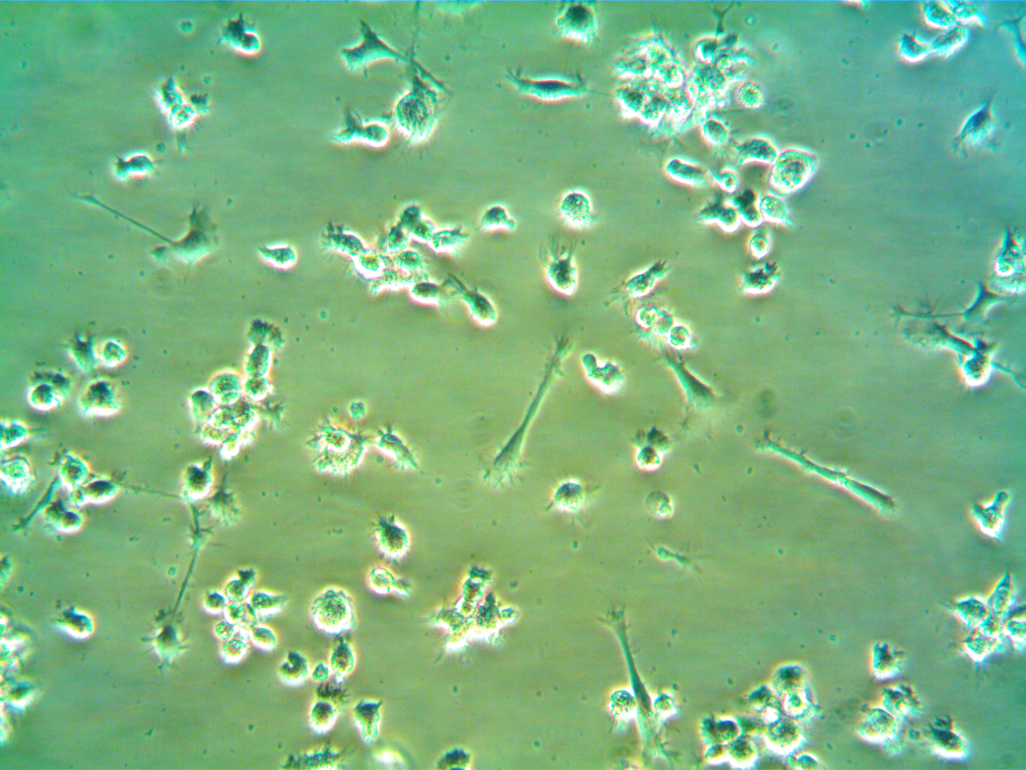 Immortalized Human Brain Microglia (cat. HBMCs001) cultured using Universal Neurite Outgrowth Media. Neurite formation can be seen.