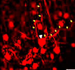RFP-Labeled Human Neuron Precursor Cells in Culture.