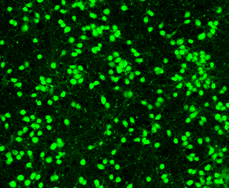 Human iPSC - GFP Glutamatergic Neurons
