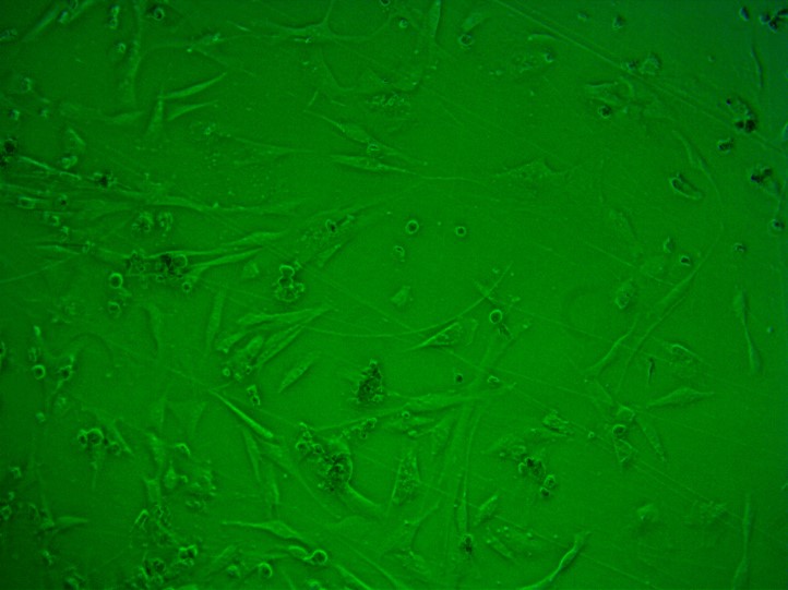 Human Umbilical Vein Microvascular Endothelial Cells (cat. HEC01) in culture using Universal Tube Formation Media. Tube formation can be observed.