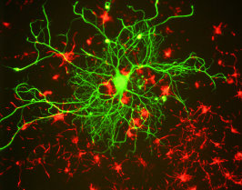 Cells grown from adult rat brain. Large cell in middle is stained with mouse monoclonal to NF-L clone DA2 (green). Another type of neuronal lineage cell was stained with rabbit polyclonal to alpha-internexin (red). These cells were mitotic but had several characteristics of neurons. Protocol on datasheet.