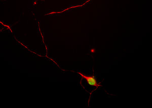 E18 hippocampal neurons (PC35101) grown for four days and stained in the red channel with our polyclonal antibody to the neurofilament subunit NF-M (CH22106) which forms short filaments in these cells at this stage. The cells were also stained in green with 39C7.