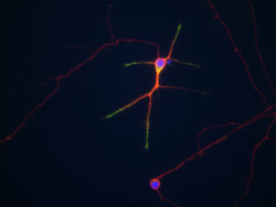 E18 hippocampal neurons stained with MAPT (red) and Doublecortin (green). The two proteins overlap in the proximal dendrites, but doublecortin is more abundant in the growth cones and periphery. As a result, the periphery appears green while the more proximal regions of the cells are yellow. The single longer process of this cell, presumably an axon, has a low doublecortin content and so appears red. Blue staining is the nuclear DNA. Protocol on datasheet.