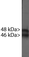 Blots of crude rat brain extract stained with Doublecortin. Protocol on datasheet.
