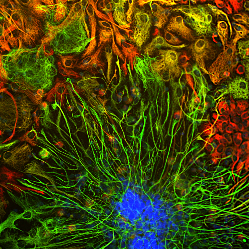 Immunofluorescent analysis of cortical neuron-glial cell cultures from E20 rat stained with mouse mAb to vimentin dilution 1:2,000 in red, and costained with chicken pAb to glial fibrillary acidic protein (GFAP) dilution 1:5,000, in green. The blue is DAPI staining of nuclear DNA. Fibroblastic and other developing cells express only vimentin and appear red. Astrocytes that express GFAP only are green while those that express both GFAP and vimentin appear golden yellow.