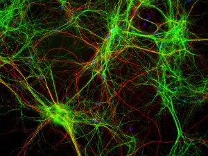 Mixed neuron/glia cultures stained with MAP-2 (green) and also rabbit antibody of neurofilament NF-H (red). Since the NF-H protein is largely expressed in neuronal axons, while the MAP2 is only found in neuronal dendrites and perikarya, there is little overlap between these two staining patterns. DNA stain shows nuclei of neurons and non-neuronal cells (blue).Protocol on data-sheet.