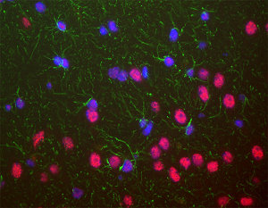 TDP43 staining of formalin fixed adult rat brain, specifically the hippocampus; whose neurons nuclei are stained strongly, nuclei of some non-neuroal cells are weakly stained. Neuronal nuclei therefore look crimson, since they are both red due to the content of TDP43 and blue due to their content of DNA, stained blue with DAPI. Chicken antibody to GFAP (G) shows the processes of astrocytic glial cells. Nuclei of all cells are revealed with DAPI DNA stain (B).