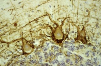Human cerebellar cortex fixed in formalin, embedded in paraffin and stained with Mouse Monoclonal NF-H using the ABC (avidin biotin conjugate) method. The section was counterstained with heamatoxylin-eosin (blue). MO22120 stains prominent basket cell axons surrounding the large Purkinje neurons. Granule cell layer at bottom of image, molecular layer at top. Protocol on Data-sheet.