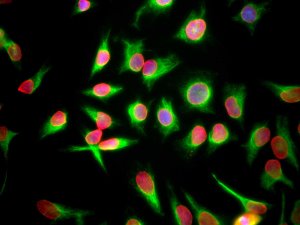 HeLa cells staing with Lamin A/C (red), and counterstained with chicken polyclonal Vimentin antibody (CH22108) to (green) and DNA (blue). The antibody reveals strong nuclear lamina staining, while the Vimentin antibody reveals cytoplasmic intermediate filaments. Protocol on datasheet.