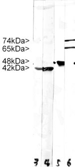 Stripe blots of crude HeLa cell extract stained with Lamin A/C. Note two strong clean bands at 74kDa and 64kkDa, corresponding to Lamin A and C, in the lane labeled 6. Lane 5 was stained with our antibody to Enolase 1, which we will market shortly. Lanes 3 and 4 were reacted with Actin, our monoclonal antibody to all six actin isotypes. Molecular weights of each protein are as indicated. Protocol on datasheet.