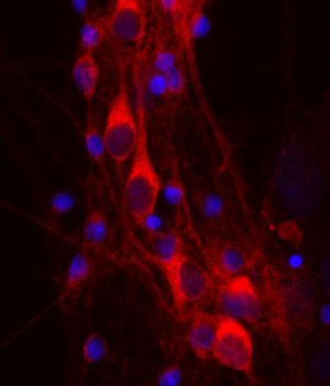 rat mixed neuron/glial cultures stained with 14-3-3 eta antibody (red). Neuronal perikarya are very rich in 14-3-3 eta which has a diffuse cytoplasmic staining pattern. Blue is a DNA stain. Protocol on data-sheet.