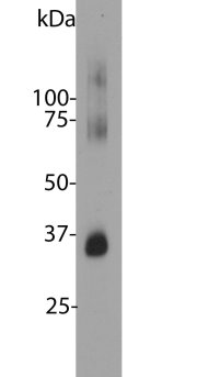 Bovine retinal extracts blotted with rhodopsin. The antibody stains a band corresponing to retinal rhodopsin at about 35kDa. Bands about 70 kDa and 140 kDa are aggregated forms of rhodopsin. Protocol on data-sheet.