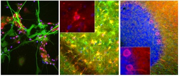 Left: View of mixed neuron/glial cultures stained with Aldolase-C (green) and our rabbit antibody to NeuN/FOX3 (red). Middle and Right: Mouse brain sections (fixed by transcardial perfusion with 4% paraformaldehyde) stained with Aldolase-C (red) and our chicken Vimentin antibody (green). Nuclei are labeled with DAPI (blue).