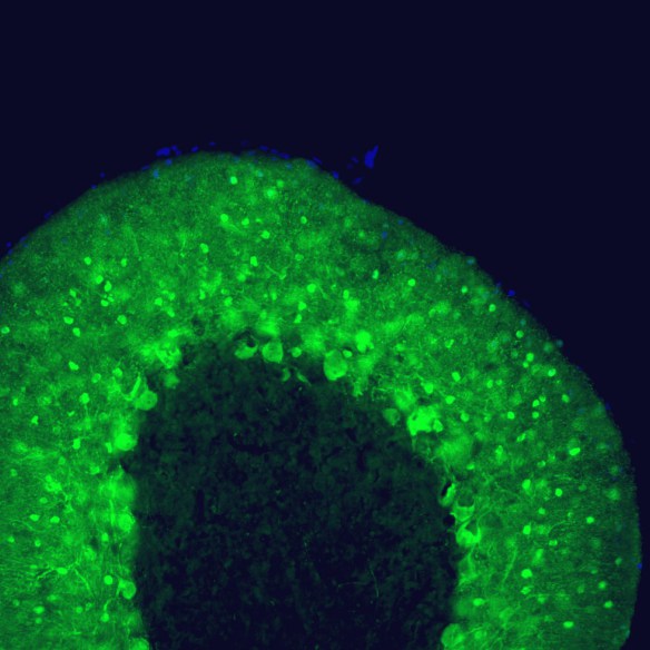 Adult rat cerebellum floating section was stained with MO22149 at 1:1,000 to parvalbumin in green. Parvalbumin is prominently expressed in the dendrites and perikarya of Purkinje cells and some interneurons in the molecular layer. Blue is a DNA stain.