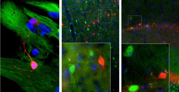 Left: Mixed neuron/glial cultures stained with MO22166 at 1:2,000 in red, and our chicken polyclonal antibody to Vimentin (CH22108) in green. Middle: Adult rat cortical section was co-stained with MO22166 (1:1000; red) and our chicken polyclonal antibody to calbindin (CH22118, green). Right: Adult mouse brain hippocampal section (45 μM; fixed by transcardial perfusion with 4% paraformaldehyde) was co-stained with MO22166 (1:1000, red) and our calbindin CH22118, (green)